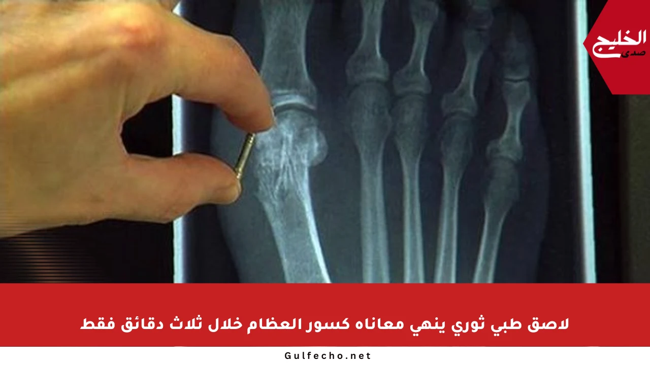 لاصق طبي ثوري ينهي معاناة كسور العظام خلال ثلاث دقائق فقط